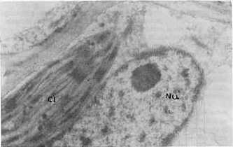 Fig. 2.Ncleo (Nu) y cloroplasto (Cl) en plantas sanas. (24 000x).