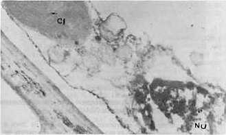 Fig. 5.Ncleo (Nu) y cloroplasto (Cl) en plantas inoculadas con el aislamiento 3. Estn severamente deformados si se comparan con las alteraciones que provocan los otros aislados. (19 200x).