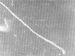 Fig. 2. Hifas de U. scitaminea visualizados por IIF