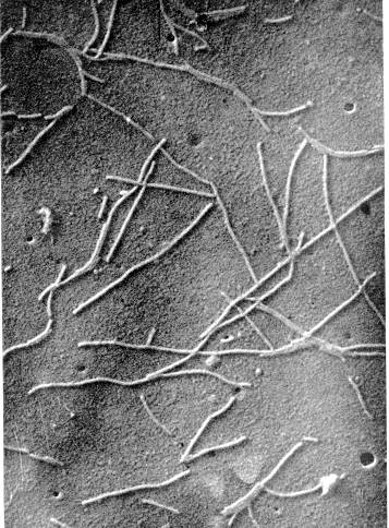 Fig.2 . Virus X del cactus proveniente de la purificacin del mismo.