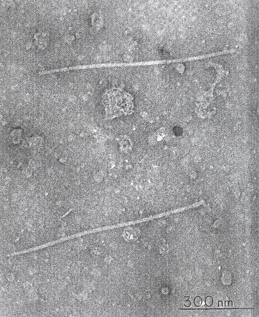Fig. 4. Partculas en forma de filamentos del VGT observadas al microscopio electrnico. Aumento: x 100.000