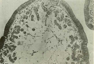 Figura 5. Oviducto con infiltracin de linfocitos y edema. H.E. 10x.