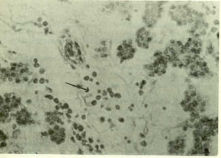 Figura 6. Oviducto con infiltracin de linfocitos y clulas plasmticas. H.E. 40x.