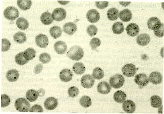 FIGURA 1. Sangre de bovino infectada con A. marginale (frotis colorado por Giemsa,87% EP) utilizada como fuente de antgeno (aumento : 1.000X)