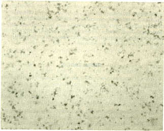 FIGURA 2. Cuerpos iniciales purificados de A. marginale Teidos por Giemsa (aumento:1.000 X)