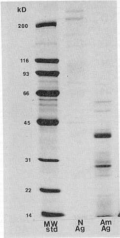 FIGURA 3 y 4. Anlisis electrofortico en gelgradiente y el gel al 10% de poliacrilamida (SDS -PEGE) del inmungeno purificado de A. marginale. De izquierda a derecha: pesos moleculares standars (MW), antgeno de eritrocitos no infectados (N) y cuerpos iniciales purificados (Am). (Colocacin.:Azul de Coomassie)