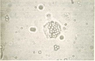 FIGURA 2. Clula Fagoctica (40x).