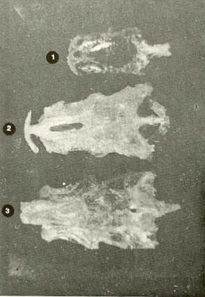 FIGURA 18a. superior del Neurocrneo de:1) Carpa (Cyprinus carpio)2) Bagre (Rhamdia humilis)3) Volador (Lebiasina erythrinoides)