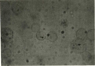 FIGURA 1. Microfotografa de Anaplasma marginale, cepa Cojedes, en sangre de bovino infectado. Ntese la presencia de apndice caudal, revelado mediante la coloracin de nuevo Azul de Mitileno (NAM). Aumento 1.000X.