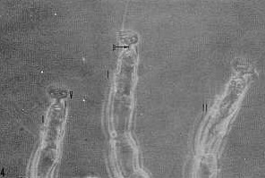 FIGURA 4. Dermatophagoides scheremetewskyi. Detalles morfolgicos  de sus patas. Se observa la ventosa (V) o ambulacros del primer par (I) y del segundo par (II) de patas. Las ventosas se unen a los pretarsos por medio de un pedicelo (p) no segmentado. 400X