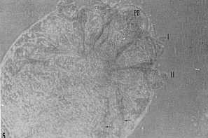 FIGURA 5. Cnemidocoptes mutans. Aspecto general del caro a 160 aumentos. PB: piezas bucales. El primer (I) y el segundo (II) par de patas apenas sobresalen de borde del cuerpo. Las flechas sealan al tercer y cuarto par de patas, las cuales son demasiado cortas. Ntese la forma circular del cuerpo de caro 160 X.