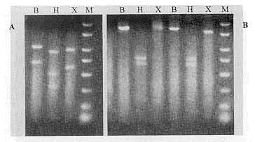 FIGURA 2. Patrones de RFLP del gen que codifica la protena S1. A= Massachusetts. B=Variante Genotpica. Se evidencia la diferencia en la longitud de los productos generados por cada una de las enzimas. B = BestYI, H = Haelll y X = Xcml. M = Marcador de peso molecular (PCR Marker Sigma-Aldrich).