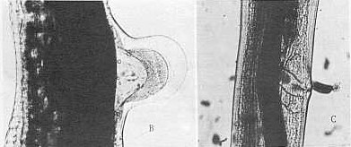 FIGURA 1. Diferentes tipos morfolgicos de labio vulvar en Haemonchus contornus: