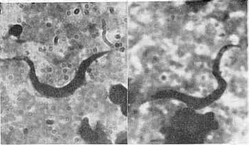 Fig.1 Trypanosoma theileri: Tripomastigotes en sangre de bovino, frotis de capa blanca (WOO) teido por el mtodo de Giemsa. Aumento: 1000x