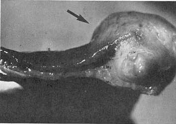 Fig. 6. Vista de un corte longitudinal del esfago. Se aprecia la localizacin del granuloma en la Submucosa (smc). Serosa (S); muscular (m) y mucosa (mc).