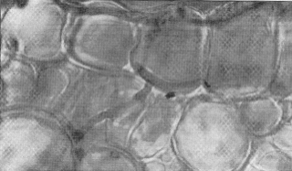 Fig. 1. Esquema de las hifas de U. scitaminea en clulas de yemas de caa de azcar de la variedad susceptible y su correspondiente fotografa  (x 100)